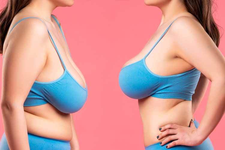 Breast Lift In Istanbul, Prices, Methods & Healing- Global Clinic
