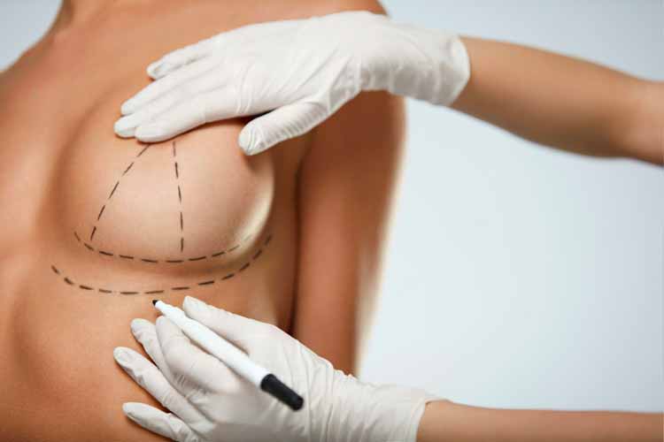 Breast Lift Surgery4