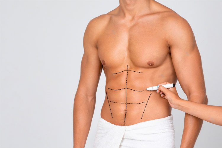 Six Pack Abs Surgery