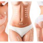 Aesthetic And Plastic Surgery Prices In Turkey