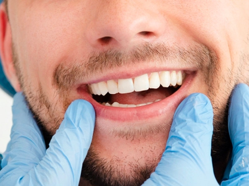 Smile Makeover The Revolutionary Trends In Dental Aesthetics