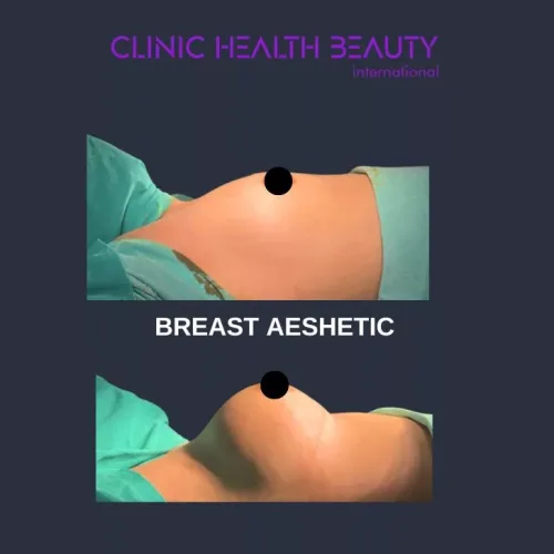 aesthetic and plastic surgery before and after photos 29