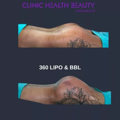 aesthetic and plastic surgery before and after photos 29