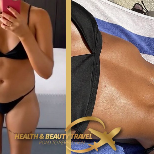 Aesthetic And Plastic Surgery Before And After Photos Png