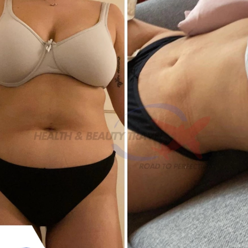 Aesthetic And Plastic Surgery Before And After Photos Png