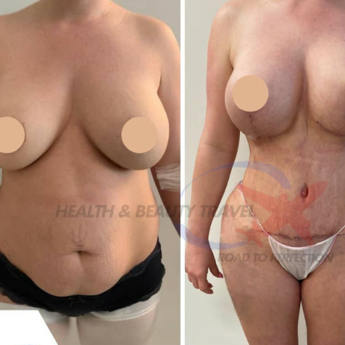 Aesthetic And Plastic Surgery Before And After Photos 12