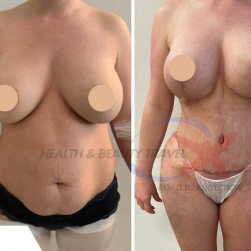 Aesthetic And Plastic Surgery Before And After Photos Png