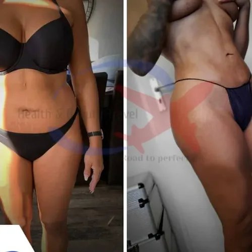 aesthetic and plastic surgery before and after photos