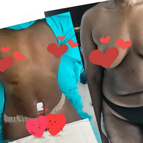 aesthetic and plastic surgery before and after photos