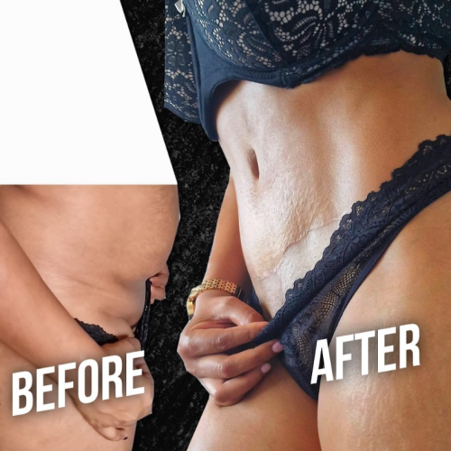 Aesthetic And Plastic Surgery Before And After Photos Png