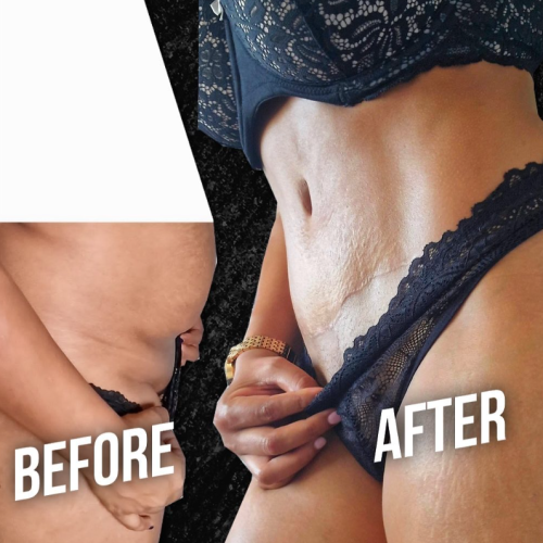Aesthetic And Plastic Surgery Before And After Photos 2