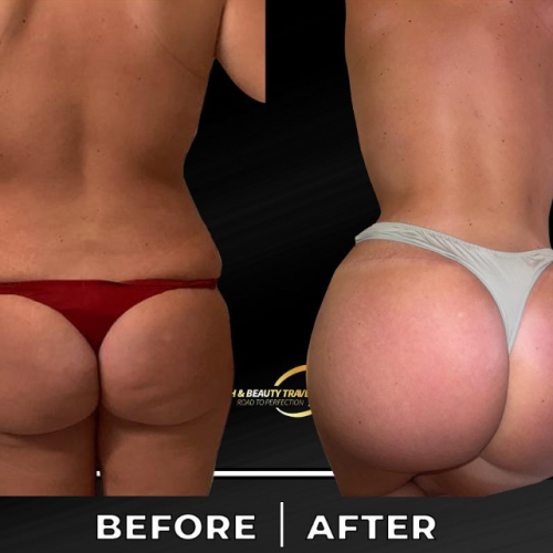 Aesthetic And Plastic Surgery Before And After Photos Png