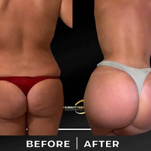Aesthetic And Plastic Surgery Before And After Photos 3