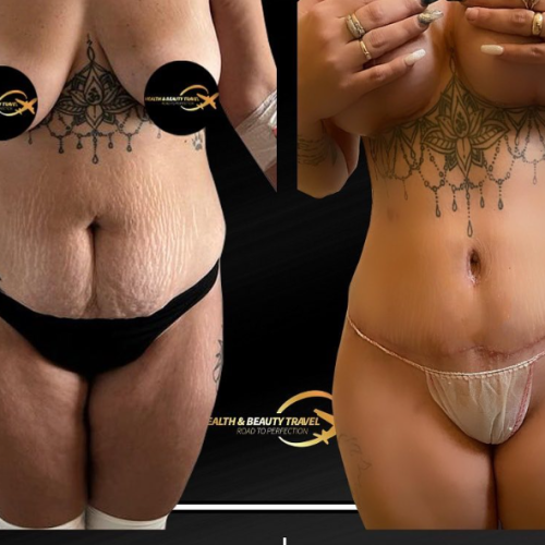 Aesthetic And Plastic Surgery Before And After Photos Png