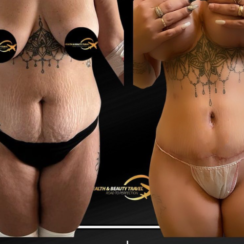 Aesthetic And Plastic Surgery Before And After Photos 4