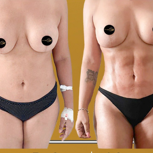 Aesthetic And Plastic Surgery Before And After Photos 5