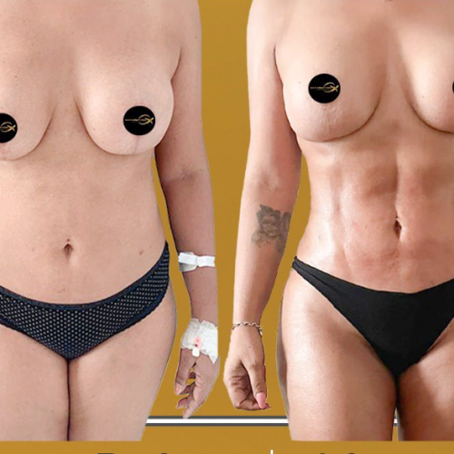 Aesthetic And Plastic Surgery Before And After Photos Png